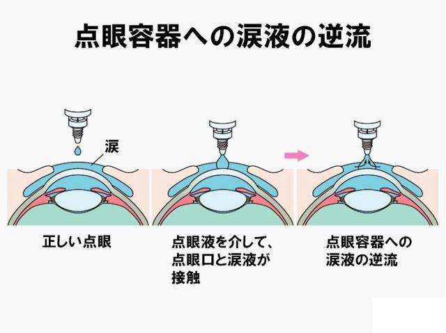 点眼方法3