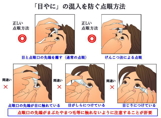 点眼方法4