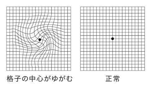 図1:変視の見え方例